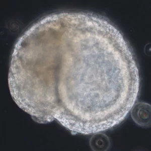 Cardiac Organoid