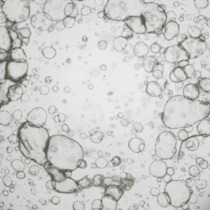 Cholangiocarcinoma Organoid