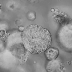 Lacrimal Gland Organoid