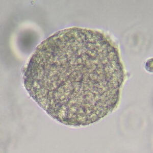 Liver Organoid