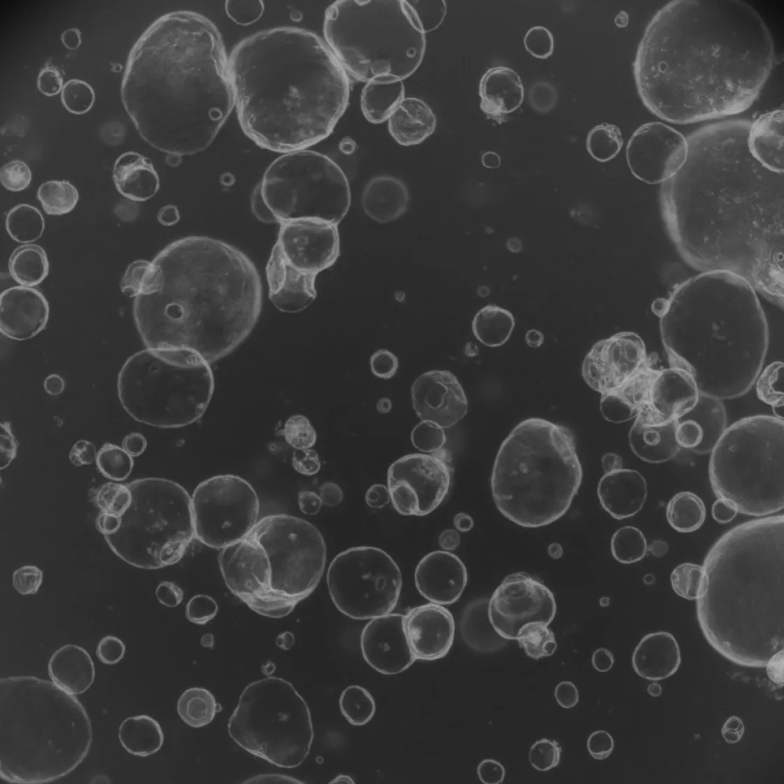 Lung Organoid_main