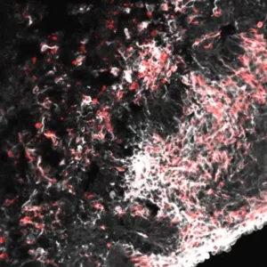 Midbrain Organoid