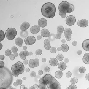 Adenoid Organoid