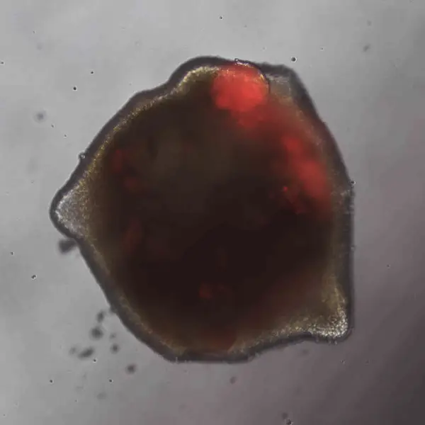 cerebral-organoid-thumb