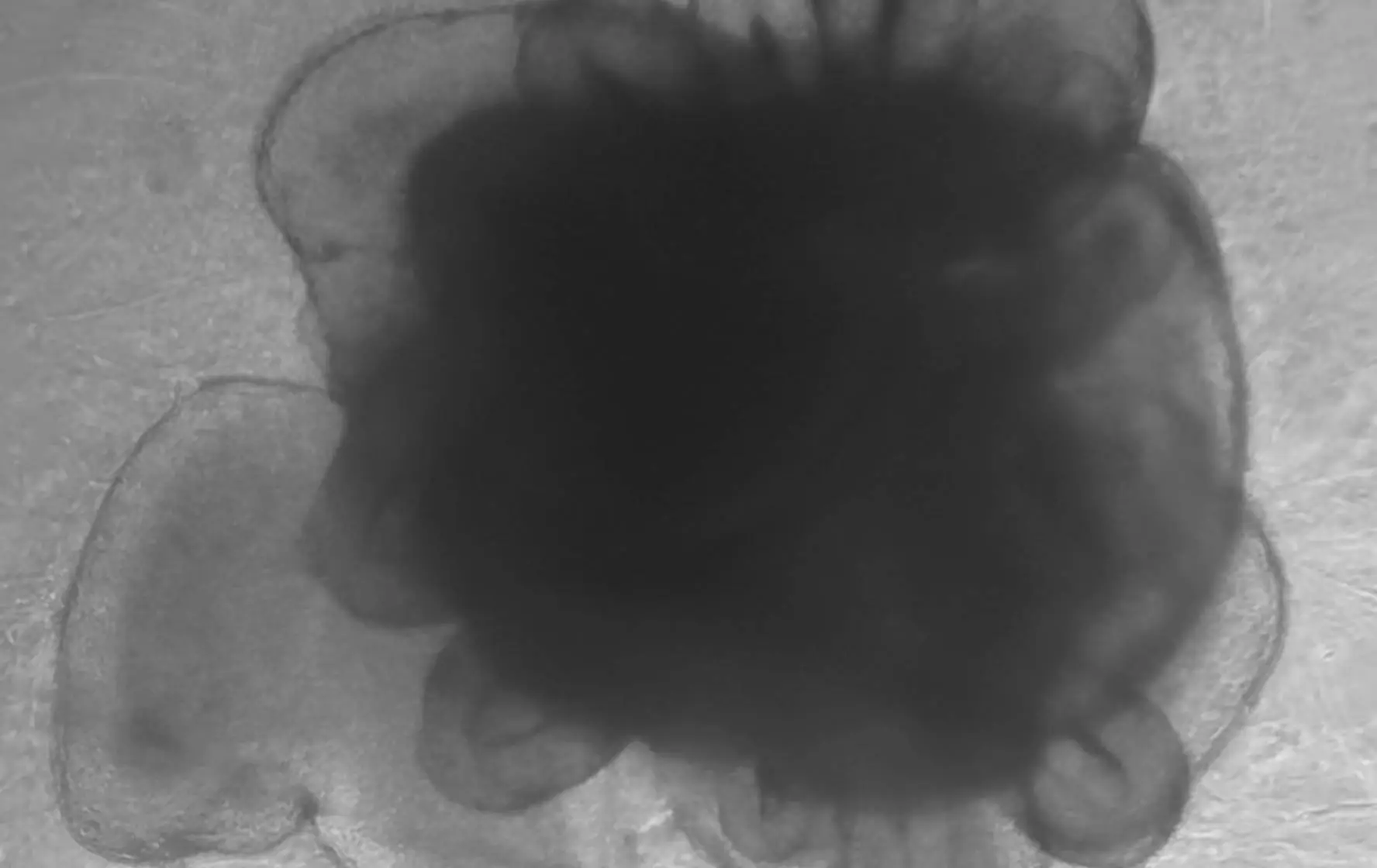 cerebral-organoid