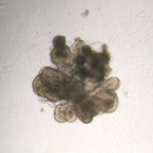 Intestinal Organoid