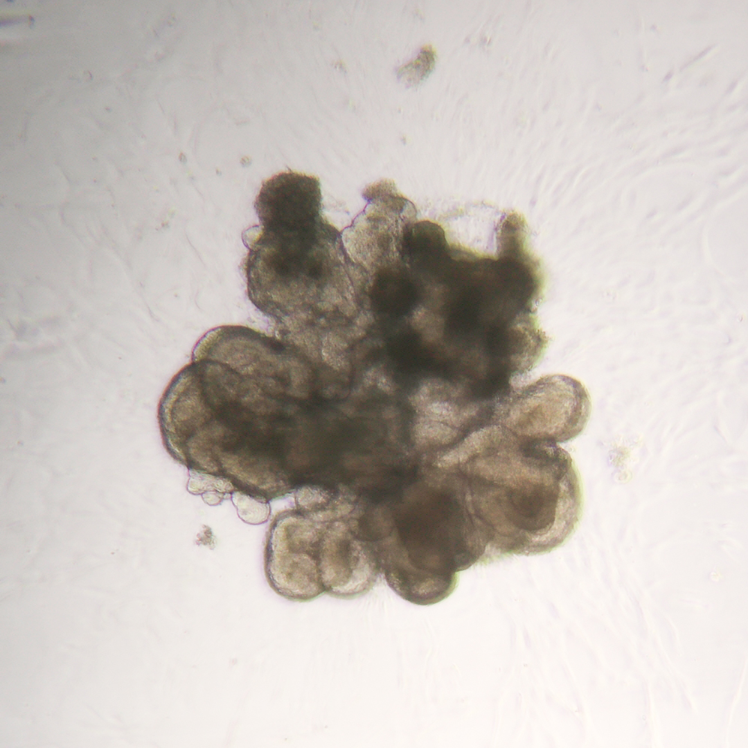 intestinal-organoid