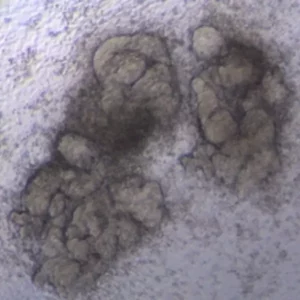 Kidney Organoid