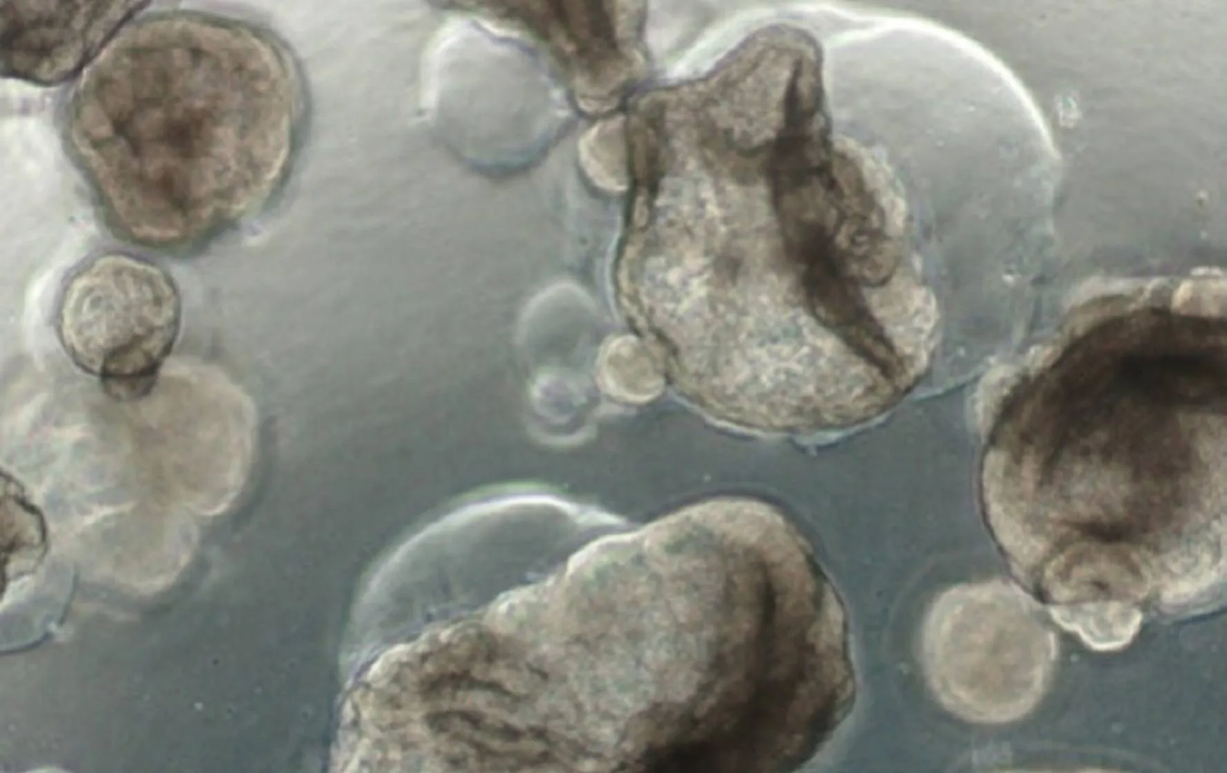 liver-organoid