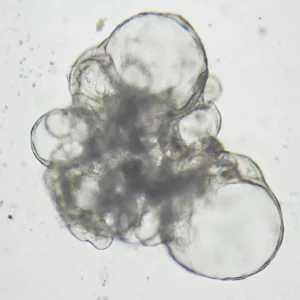 Lung Organoid