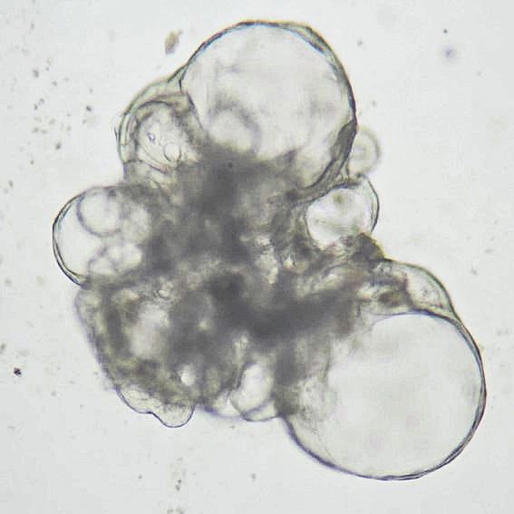 lung-organoid