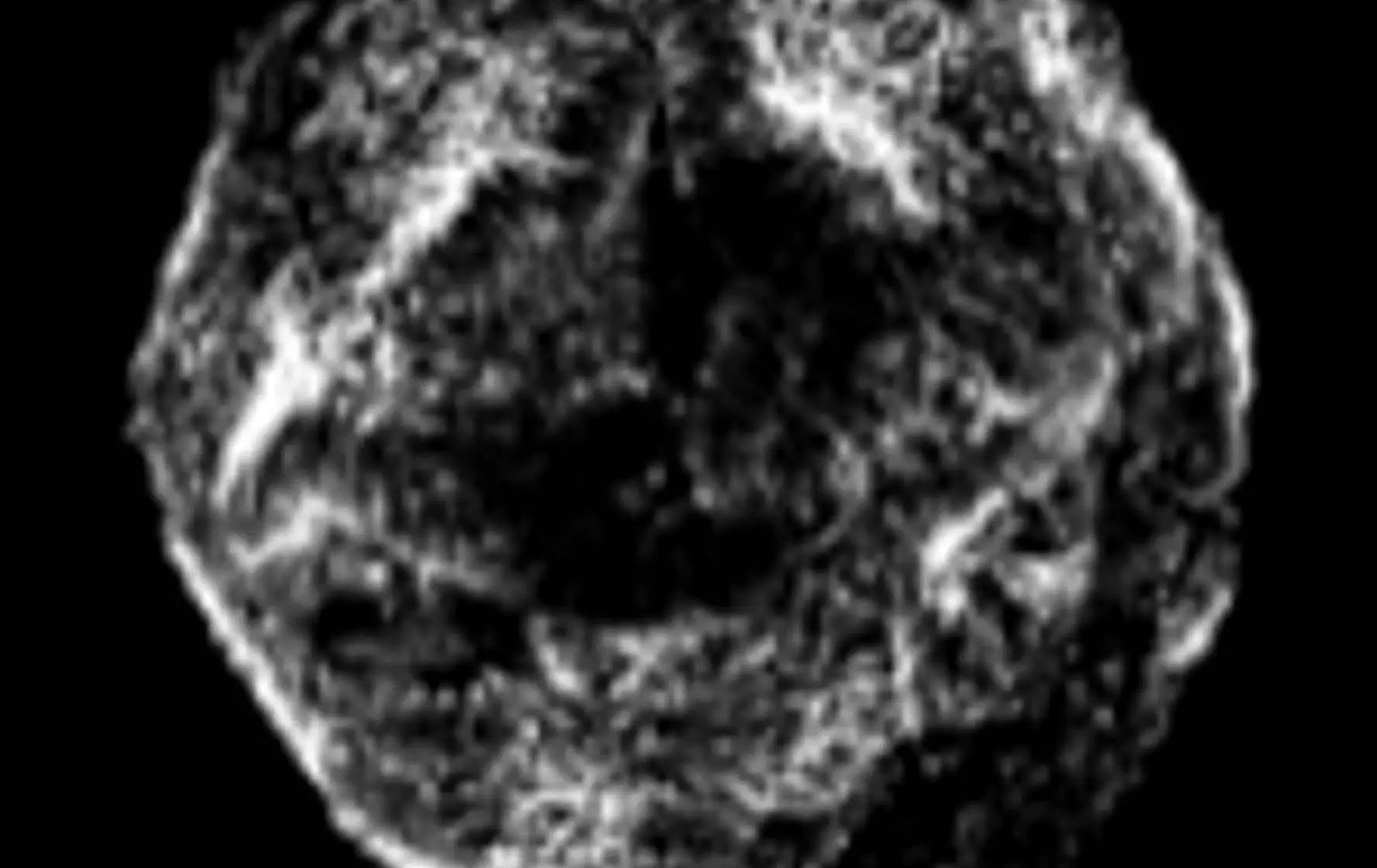 midbrain-organoid