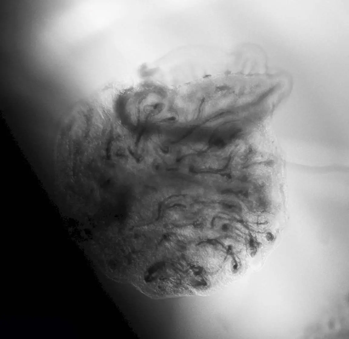 skin-hair-follicle-organoid