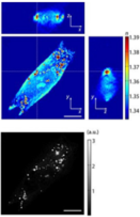 lipid_quantification_01