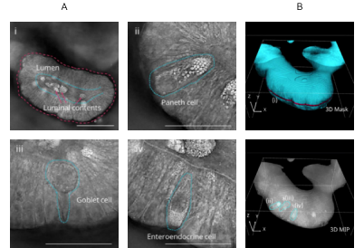 organoid_visualization_01