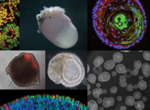 Organoids