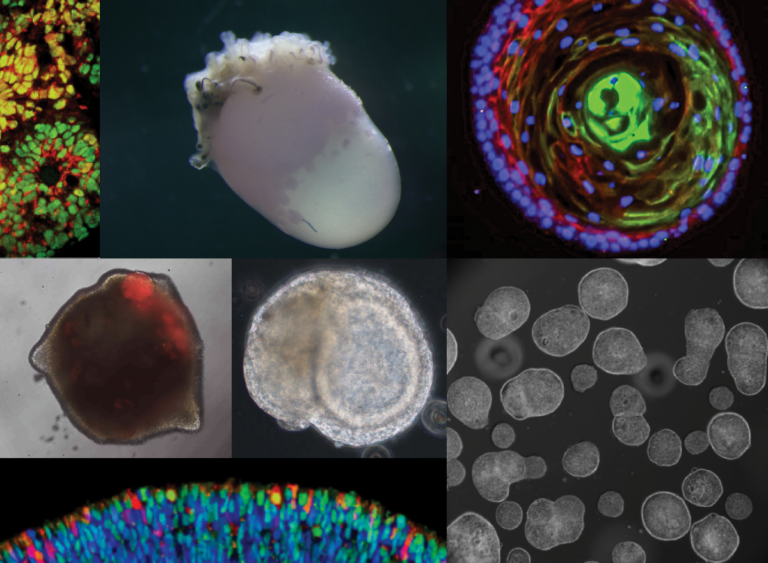 Organoids