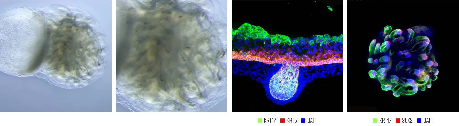 skin-hair-follicle-organoid-img5 - Lambda Biologics