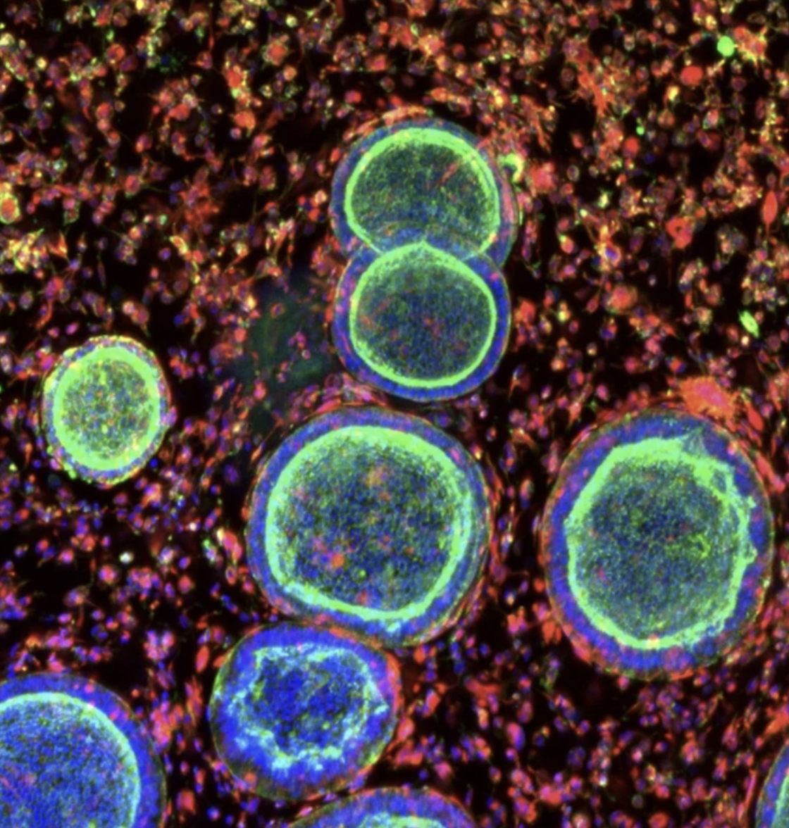 Cell clusters that resemble the uterine lining grow with support cells in a synthetic hydrogel.