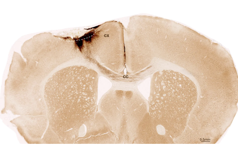 Neural Stem Cells Demonstrate Functional Stroke Recovery
