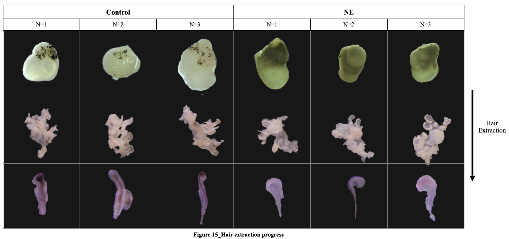 Hair Extraction & Morphology analysis