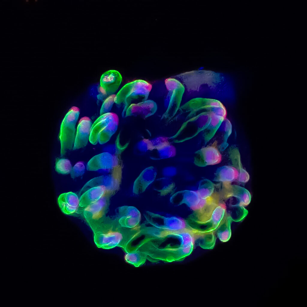 human hair organoid - Lambda Biologics - Lambda Biologics organoid