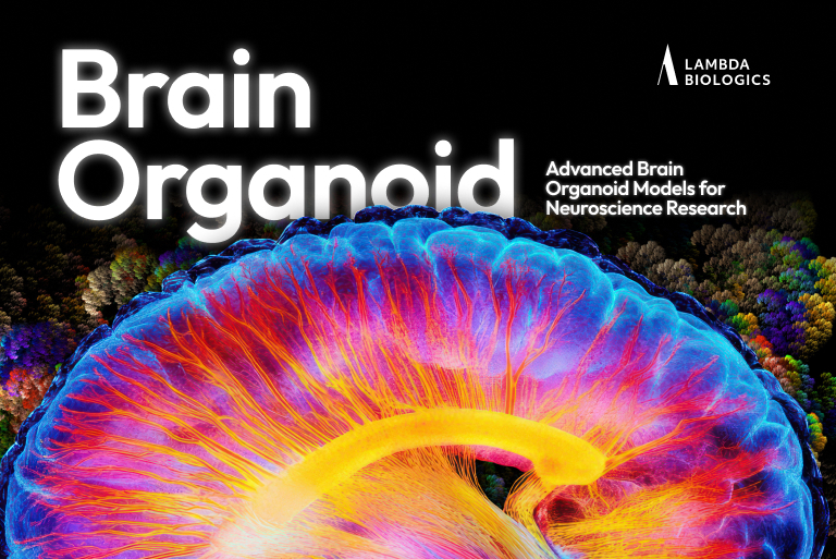 brain organoid