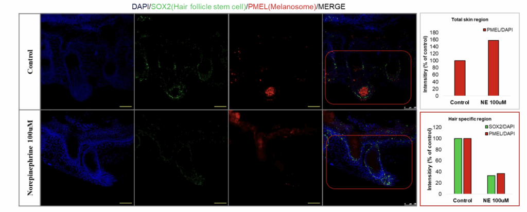 Quantification of hair shaft pigmentation based on ImageJ analysis of hair blackness.