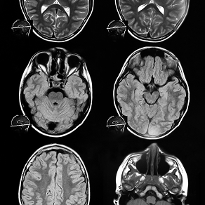 disease-model-01 - Lambda Biologics