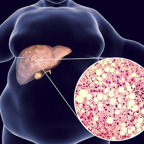 disease-model-07 - Lambda Biologics