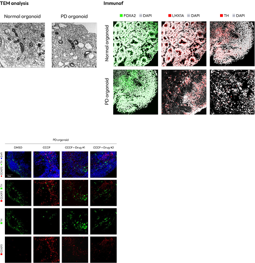 parkingson-img - Lambda Biologics