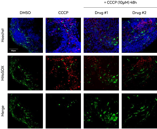 parkingson-img2 - Lambda Biologics