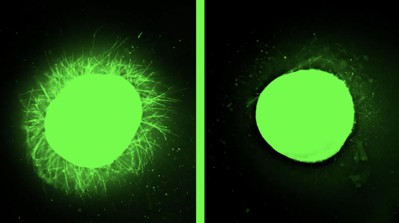 Lab-Grown Human Spinal Cord Model Reveals Promising Regenerative Therapy - Lambda Biologics Lab-Grown Human Spinal Cord Model Reveals Promising Regenerative Therapy