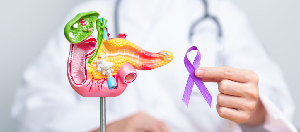 Doctor holding Purple ribbon with human Pancreas model for suppo - Lambda Biologics