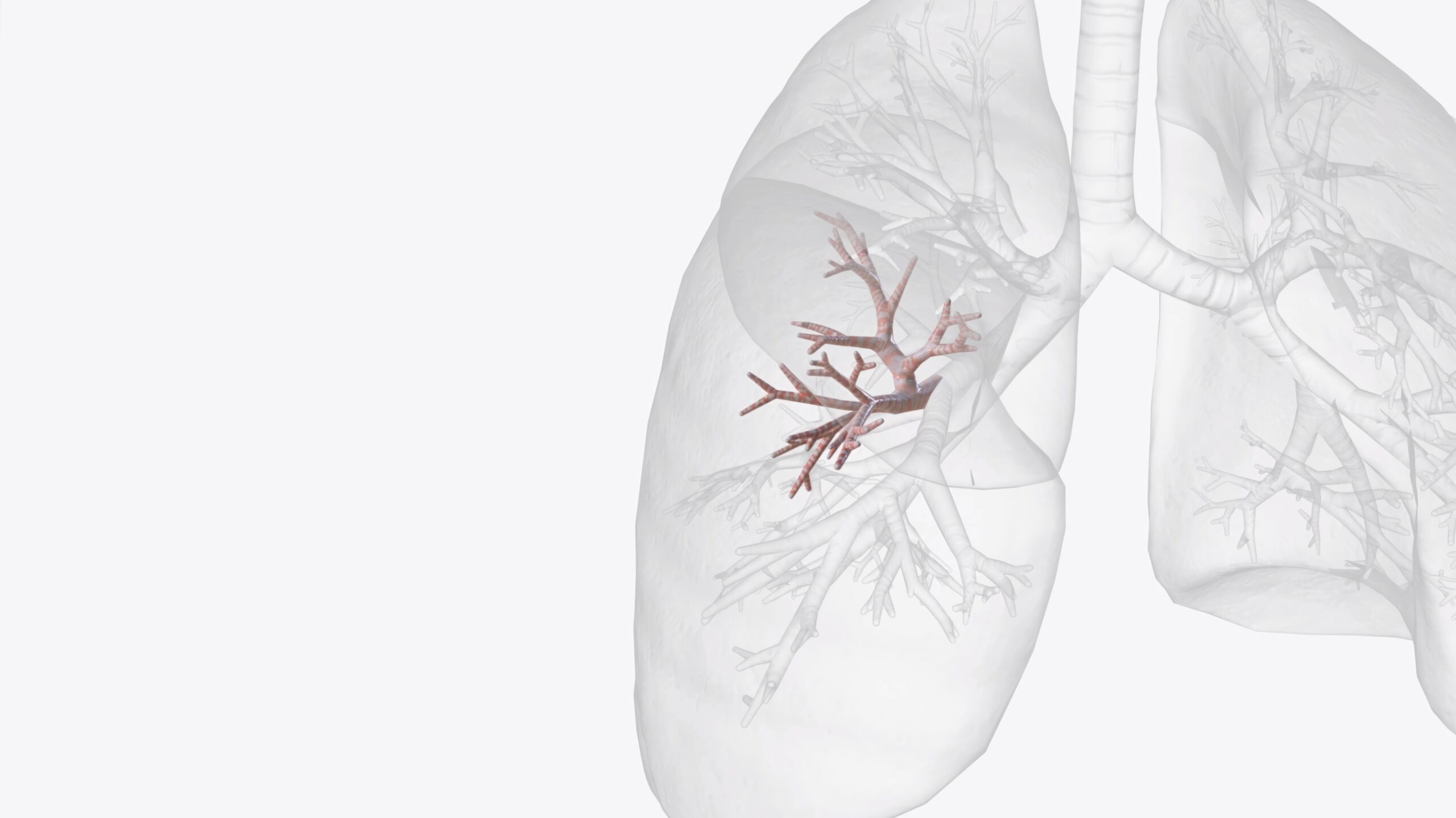 Modeling Pulmonary Fibrosis Using Human Lung Organoids