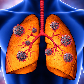 disease-model-04-1 - Lambda Biologics