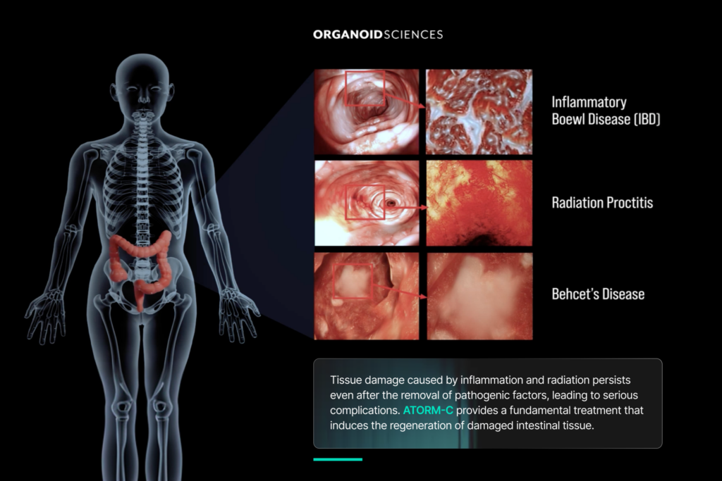 OrganoidSciences received IND approval from Korea's MFDS for ATORM-C