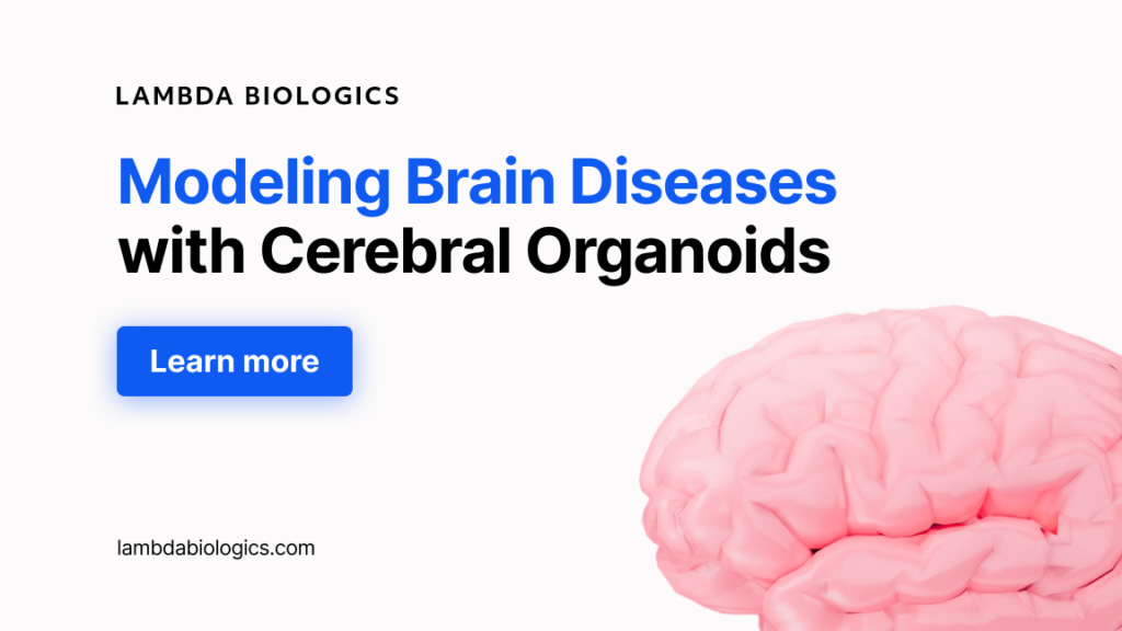 cerebral organoid