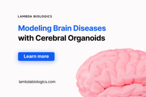 Modeling Brain Diseases With Human Cerebral Organoids