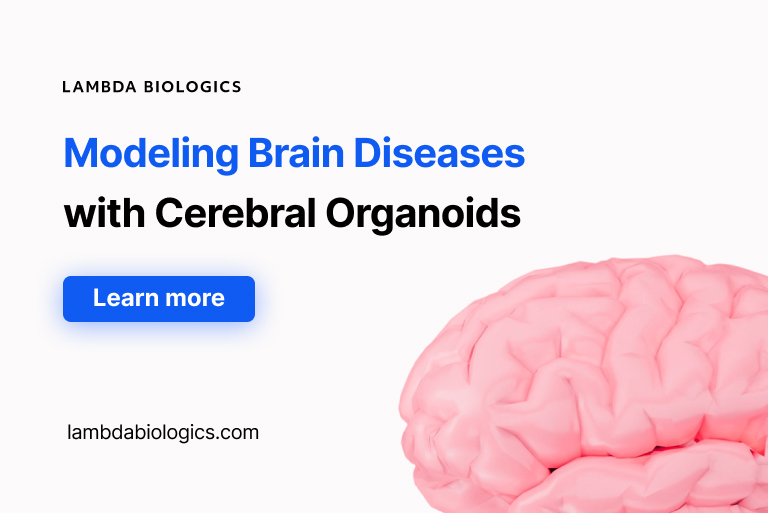 Modeling Brain Disease Using Human Organoid