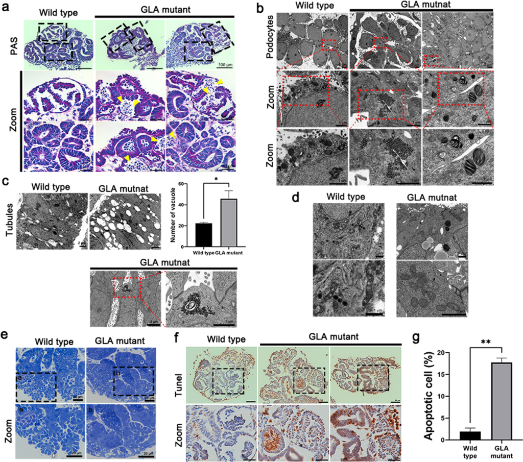 GLA-mutant kidney organoids recapitulated human renal Fabry disease.