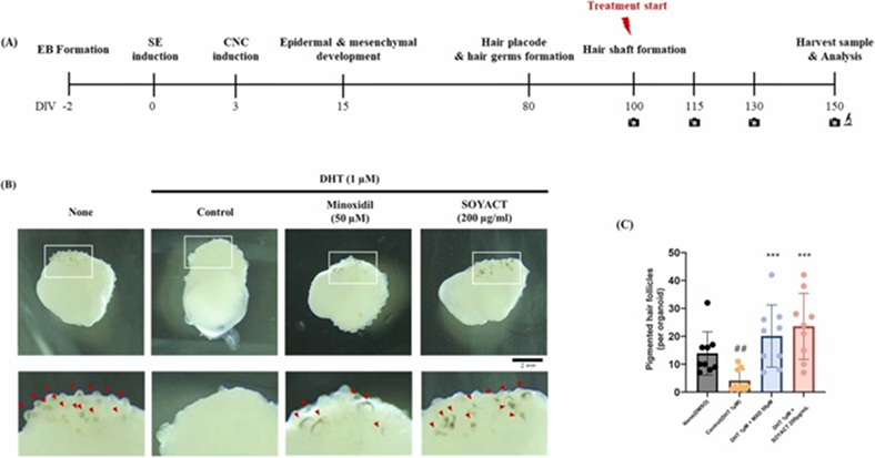 Panel A shows a developmental timeline from EB formation to harvest/analysis with labeled stages. Panel B displays four treatment groups (None, Control, Minoxidil 50 μM, SOYACT 200 μg/mL) with top and magnified bottom images of EBs highlighting areas of interest and red markers. Panel C presents a bar chart of the percentage of hair follicle-like structures across groups with error bars and significance marks.
