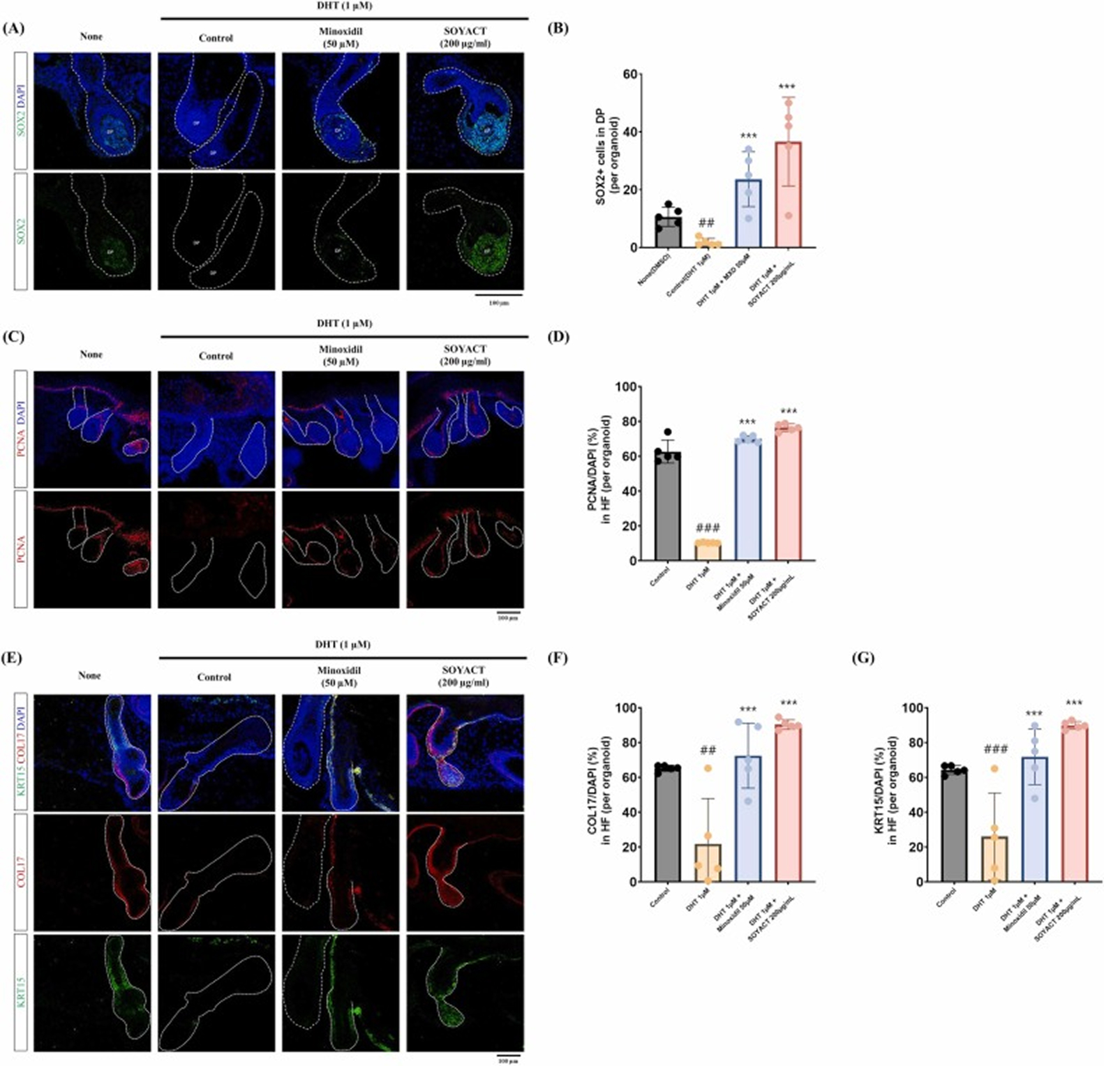 Series of panels showing immunofluorescent images of organoids with DAPI nuclear stain and marker signals under different treatments (None, Control, Minoxidil, SOYACT) and corresponding bar graphs quantifying marker-positive cells per organoid.
