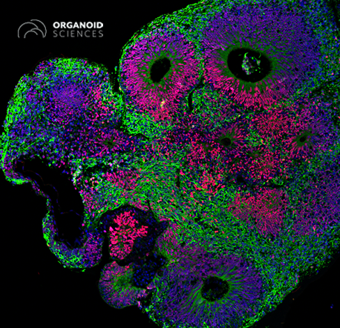 iPSC Brain Organoid - Lambda Biologics - Lambda Biologics Fluorescently stained organoid tissue with vibrant green, purple, and magenta regions; Organoid Sciences logo appears in the top-left.