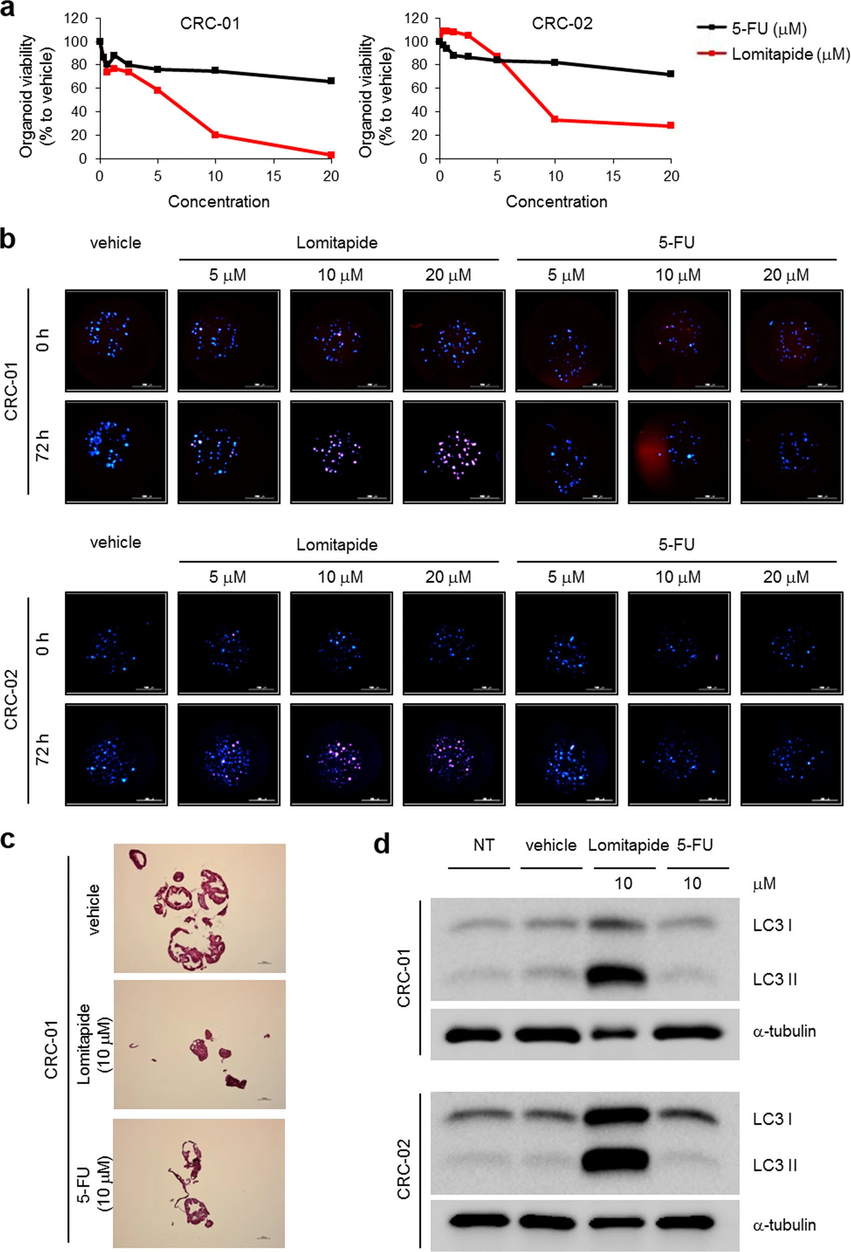 Multi-panel figure: (a) dose–response viability curves for CRC-01 and CRC-02 with 5-FU and lomitapide; (b) fluorescence images showing nuclear staining under each treatment across time points; (c) histology of vehicle, lomitapide, and 5-FU conditions for CRC-01; (d) western blots showing LC3 I/II and α-tubulin under different treatments.
