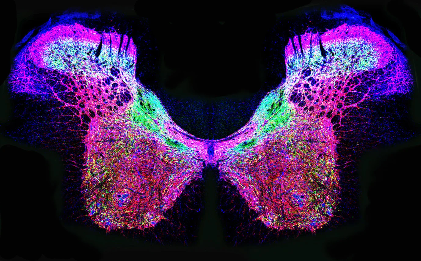 Fluorescent micrograph of bilateral neural tissue with pink, blue, and green staining highlighting neural networks in a butterfly-shaped cross-section.