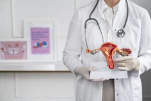 ovarian cancer
