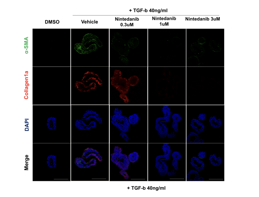 Fibrosis lung models Lambda Biologics Fibrosis lung models