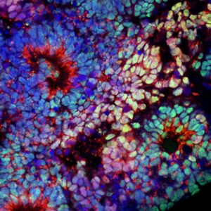 Fluorescently stained tissue showing multi-colored cells under a microscope (blue, green, purple, red).