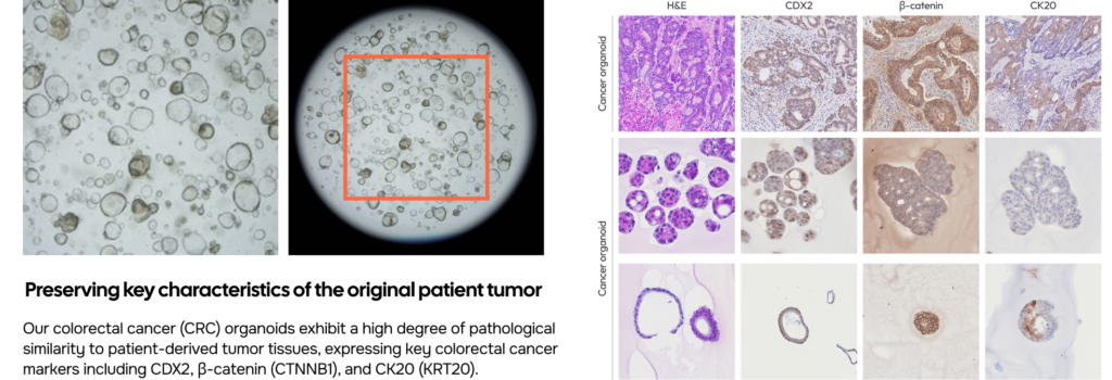 CRC Organoid Validation